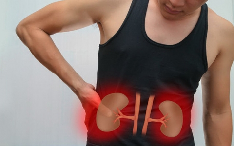 Ugonjwa wa Figo Unaohusiana na UKIMWI (HIV Associated Nephropathy)